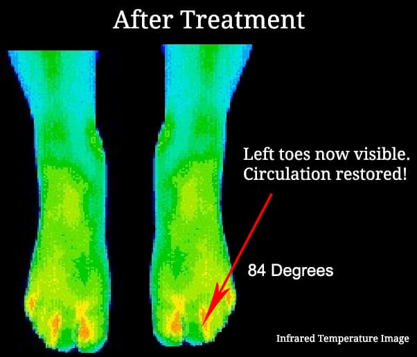 after-treatment-infrared-temperature