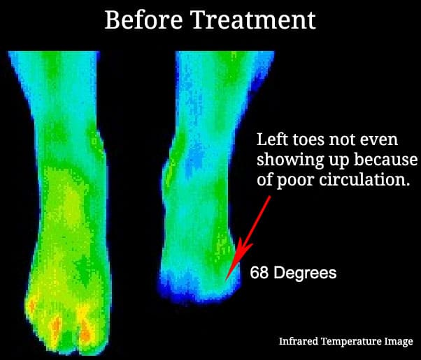 before-treatment-infrared-temperature_0