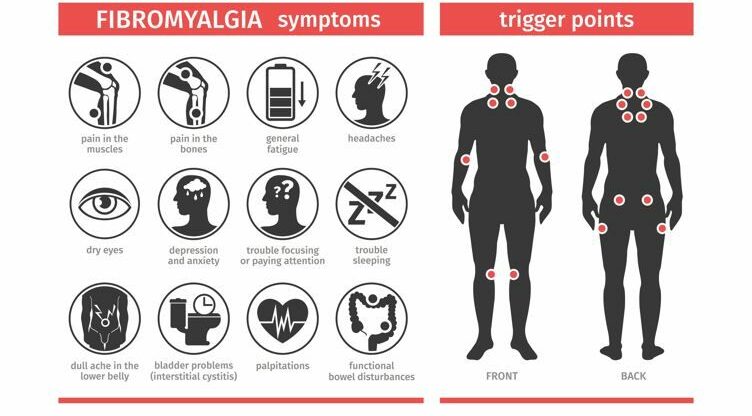 Fibromyalgia Therapy Treatment Innovative Therapy Canada