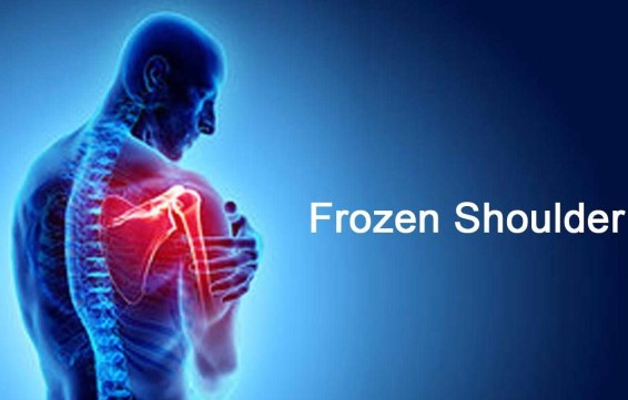 Frozen_Shoulder_Innovative_Therapy_Canada