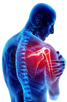 Frozen Shoulder Treatment Innovative Therapy Canada