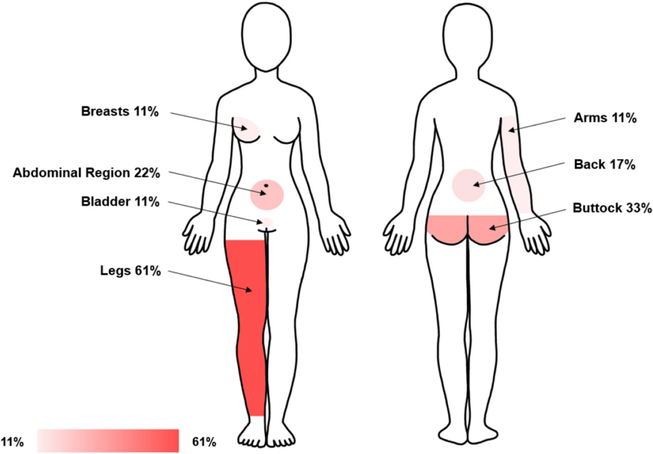 PGAD Persistent Genital Arousal Disorder - Innovative Therapy Canada.