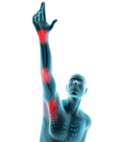 Thoracic Outlet Syndrome Symptoms Treatment Innovative Therapy Canada