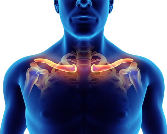 Thoracic Outlet Syndrome Treatment Innovative Therapy Canada