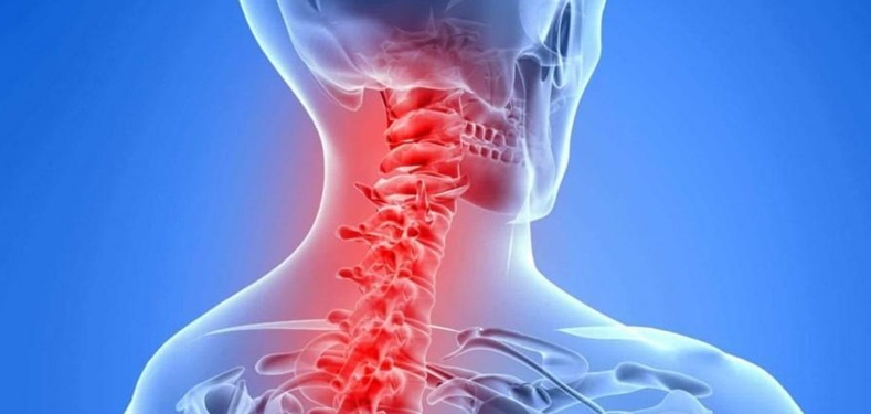 Chronic Head Neck Pain Therapy Treatment Innovative Therapy Canada
