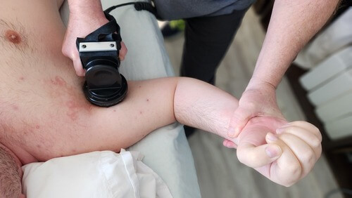 Trigenics Therapy Treatment Frozen Shoulder Innovative Therapy Canada Cornwall