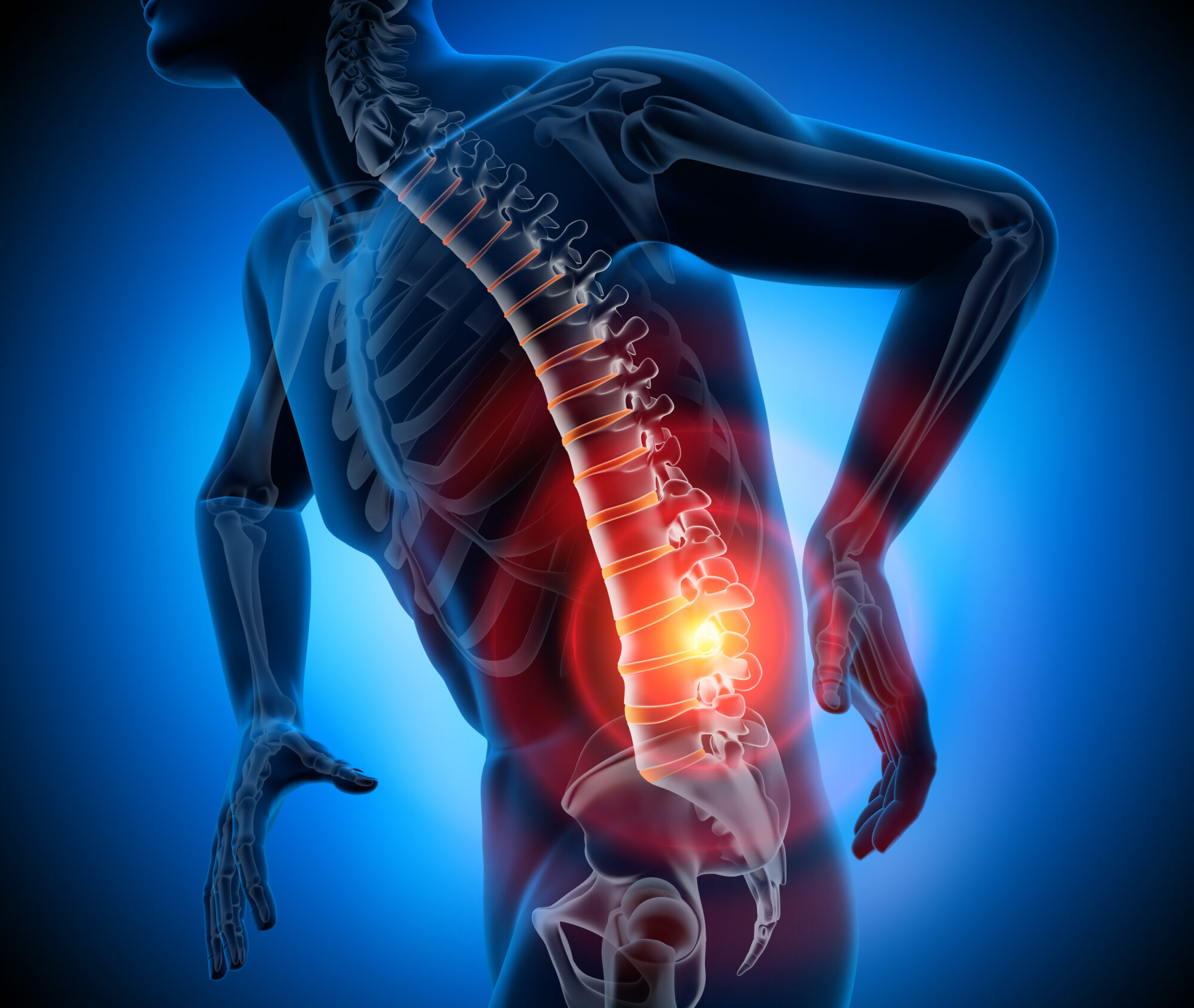 Sciatica Chronic Pain Symptoms Innovative Therapy Canada